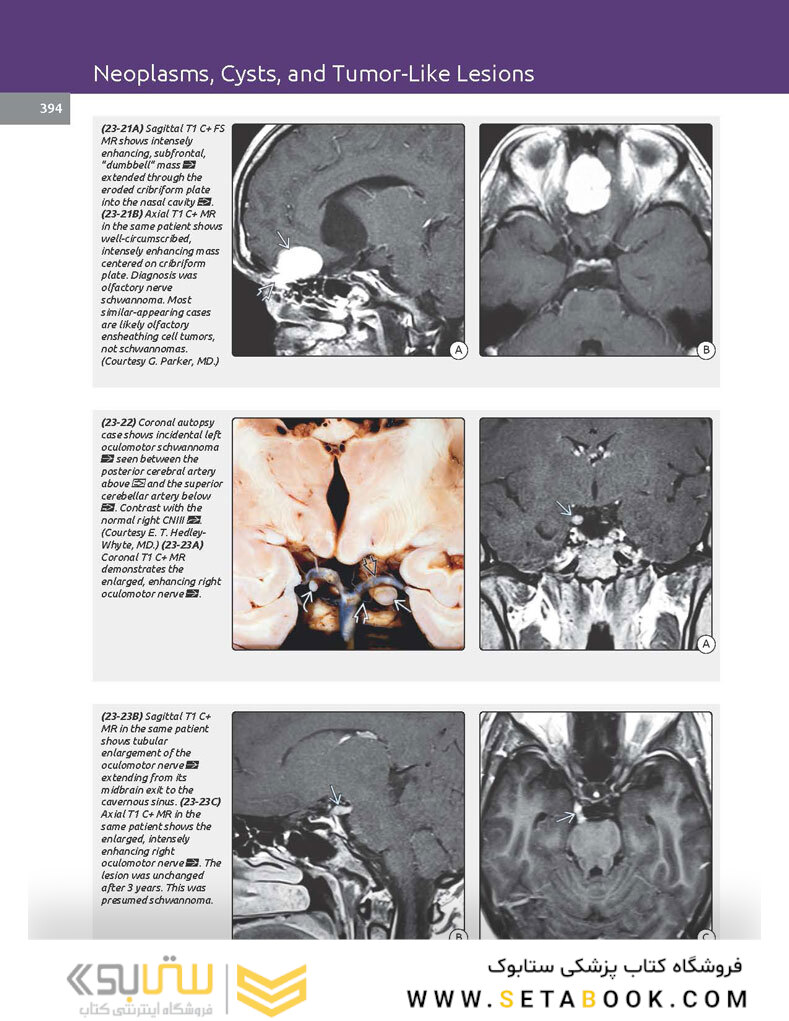 Essentials of Osborn