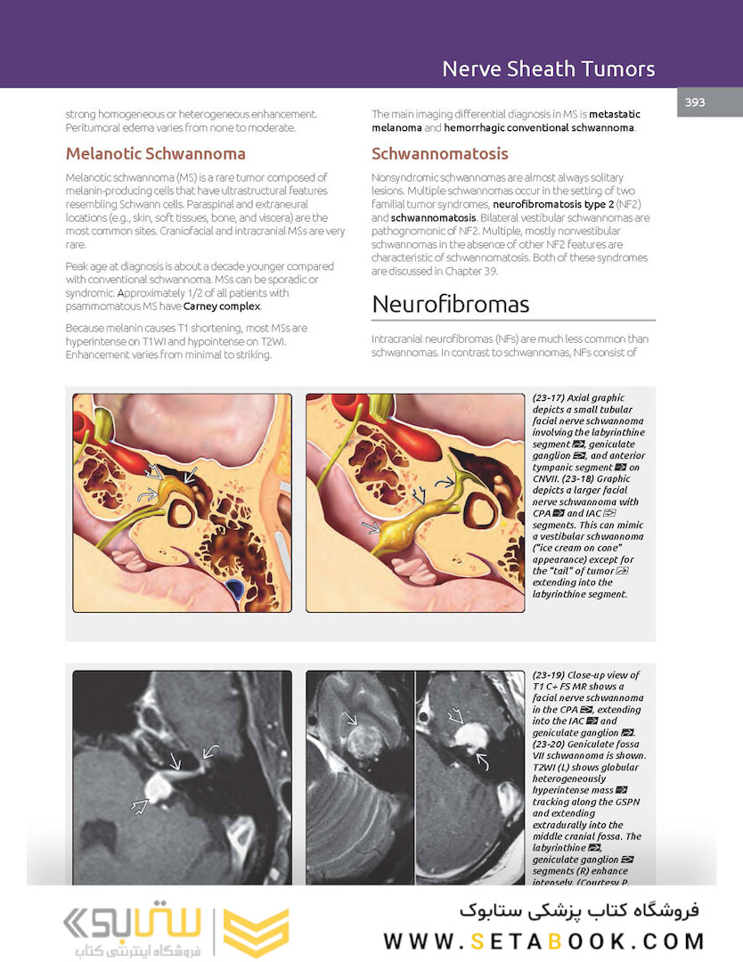 Essentials of Osborn