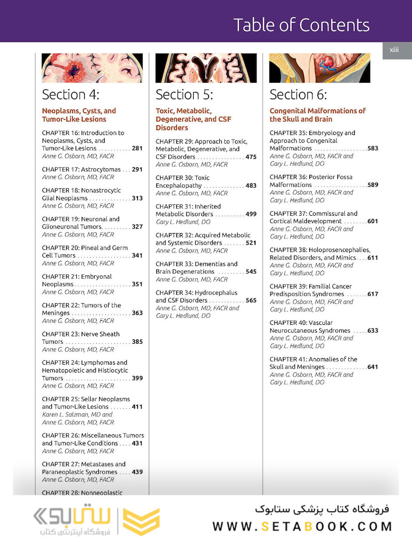 Essentials of Osborn