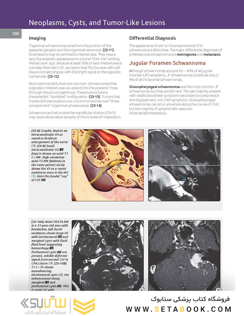 Essentials of Osborn