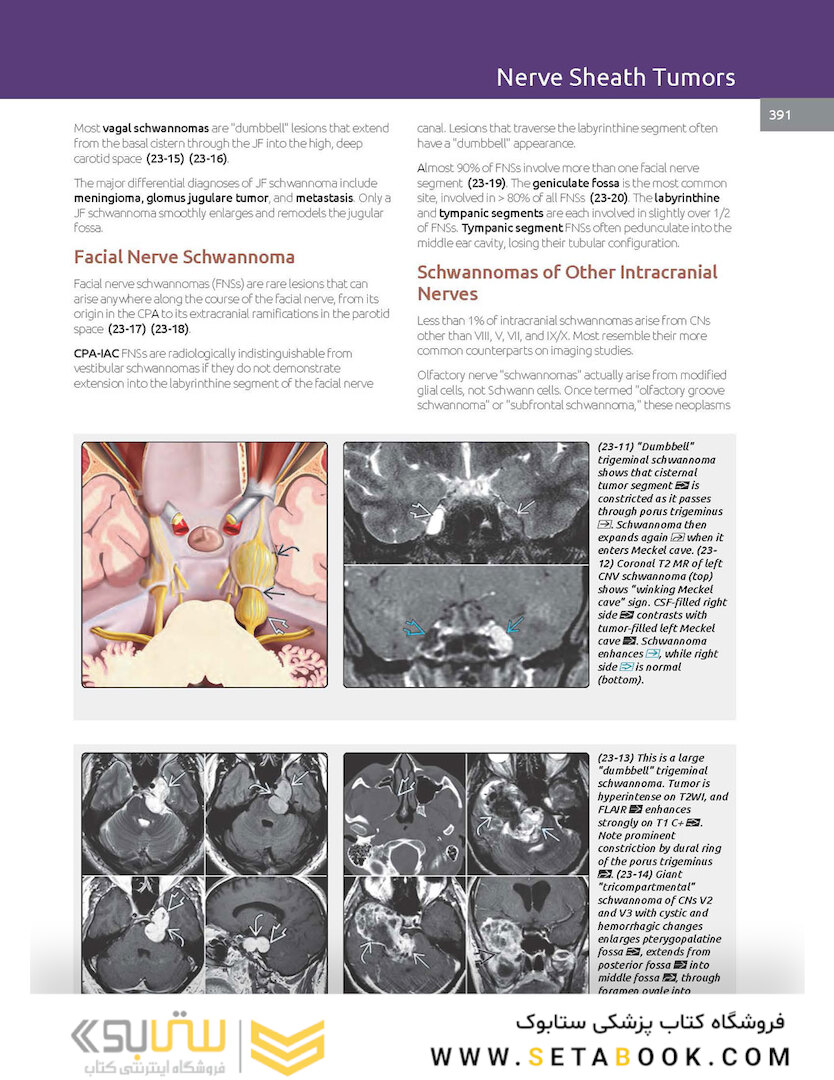 Essentials of Osborn