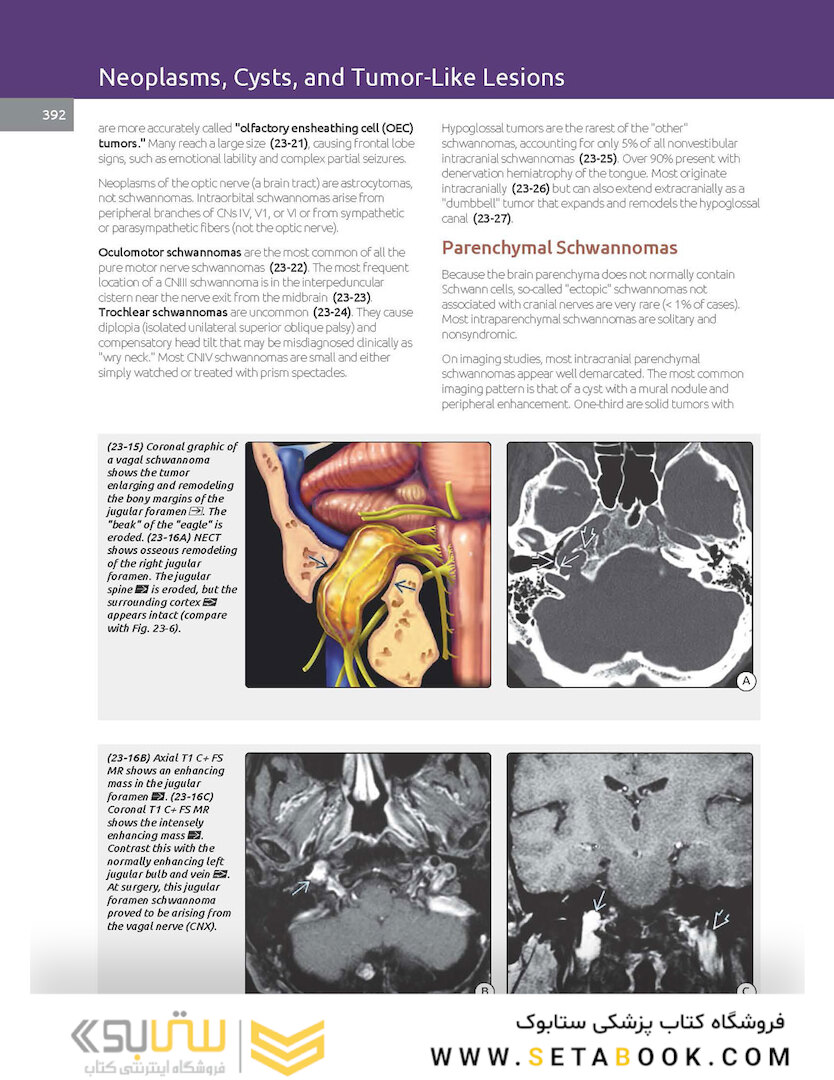 Essentials of Osborn