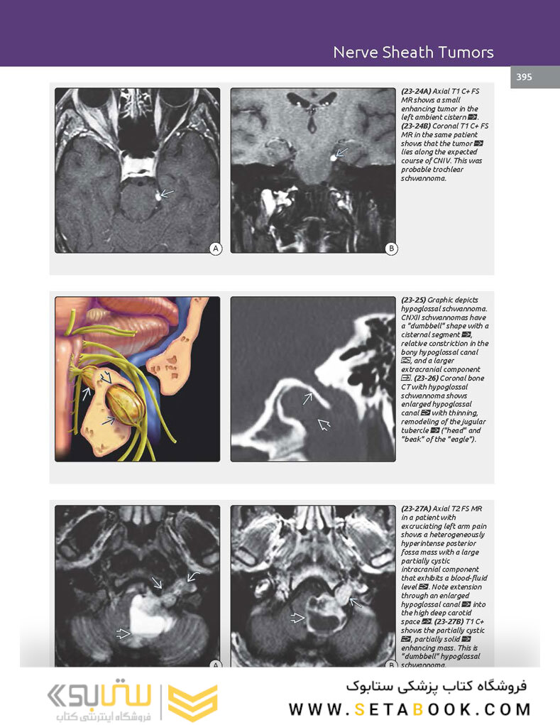 Essentials of Osborn