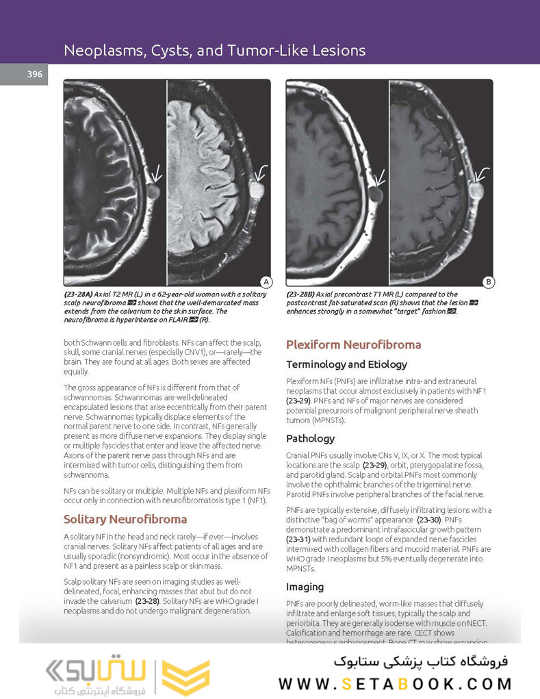 Essentials of Osborn