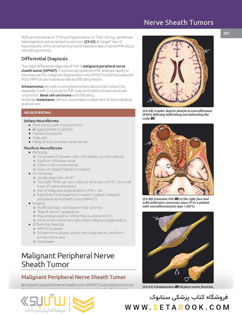 Essentials of Osborn