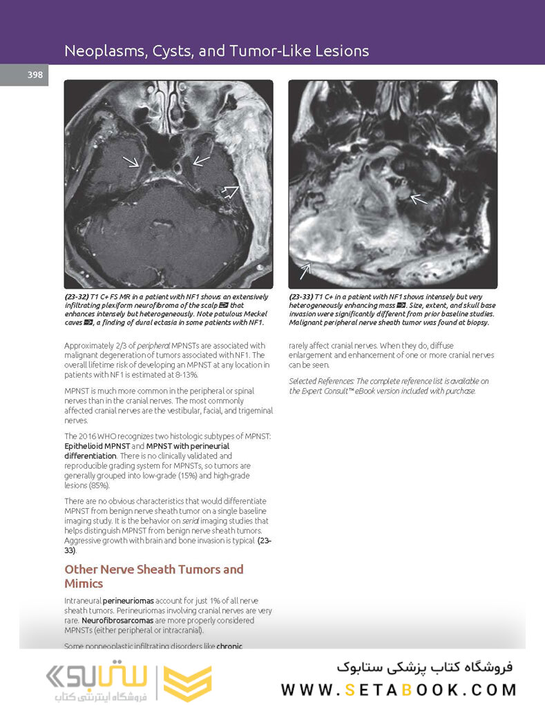 Essentials of Osborn