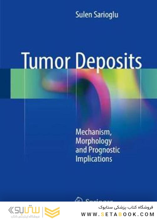 Tumor Deposits: Mechanism, Morphology and Prognostic Implications2018