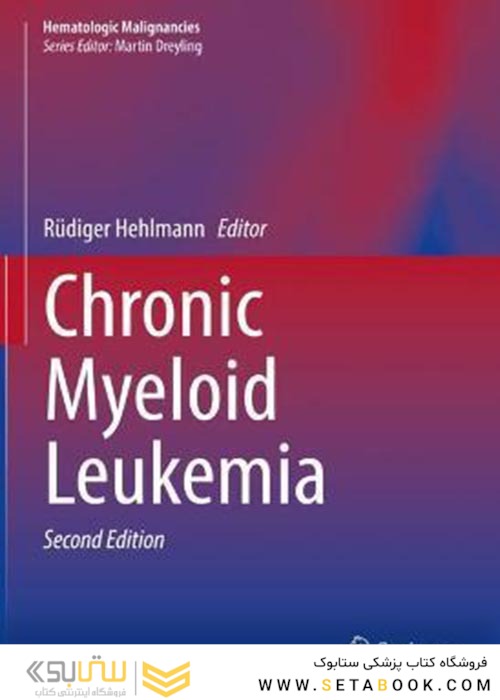 Chronic Myeloid Leukemia2021لوسمی میلوئید مزمن