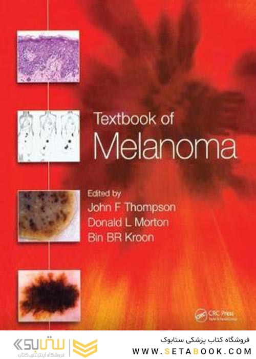 Textbook of Melanoma : Pathology, Diagnosis and Management2020کتاب درسی ملانوم: آسیب شناسی ، تشخیص و مدیریت