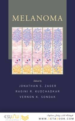 Melanoma2016ملانوم