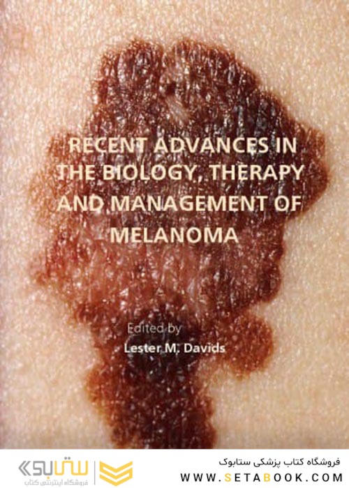 Recent Advances in the Biology, Therapy and Management of Melanoma2013پیشرفت های اخیر در زیست شناسی ، درمان و مدیریت ملانوم