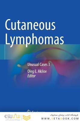 Cutaneous Lymphomas : Unusual Cases 3لنفوم های جلدی: موارد غیر معمول 3
