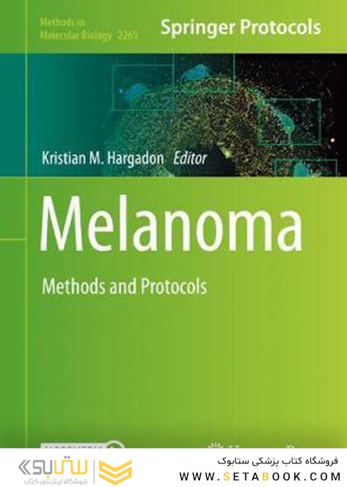 Melanoma : Methods and Protocols2021ملانوم: روشها و پروتکلها