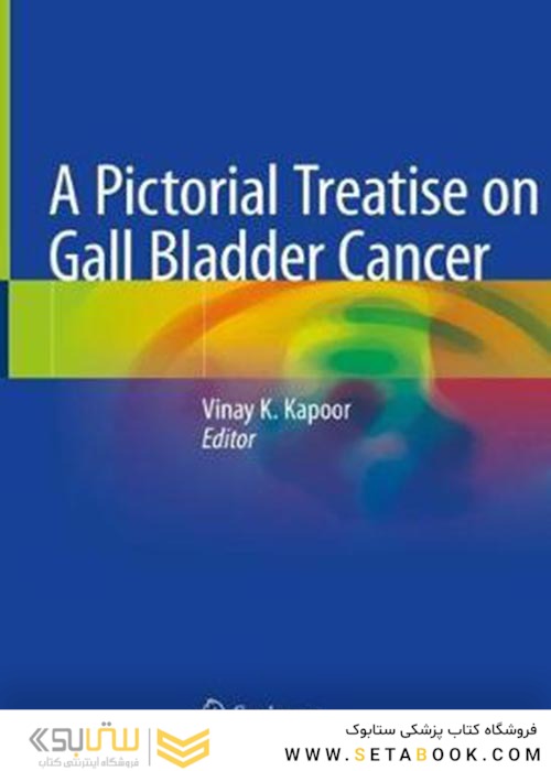 A Pictorial Treatise on Gall Bladder Cance2021رساله تصویری درباره سرطان کیسه صفرا