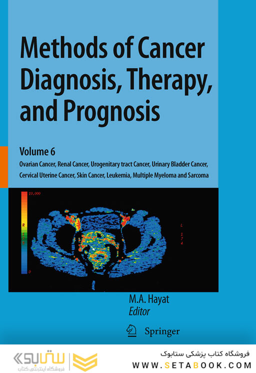 Methods of Cancer Diagnosis, Therapy, and Prognosis : Ovarian Cancer, Renal Cancer, Urogenitary tract Cancer, Urinary Bladder Cancer, Cervical Uterine Cancer, Skin Cancer, Leukemia, Multiple Myeloma and Sarcoma2016