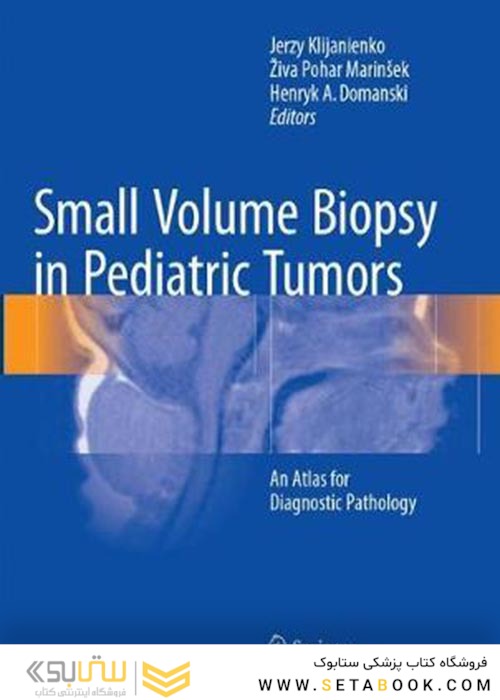 Small Volume Biopsy in Pediatric Tumorsبیوپسی حجم کوچک در تومورهای کودکان