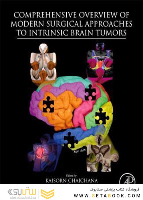 Comprehensive Overview of Modern Surgical Approaches to Intrinsic Brain Tumors2019مروری جامع بر رویکردهای جراحی مدرن در تومورهای مغزی ذاتی