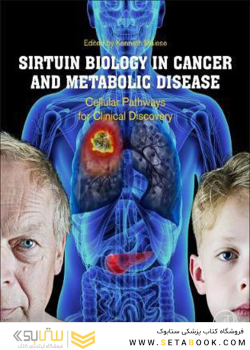 Sirtuin Biology in Cancer and Metabolic Disease : Cellular Pathways for Clinical Discovery
