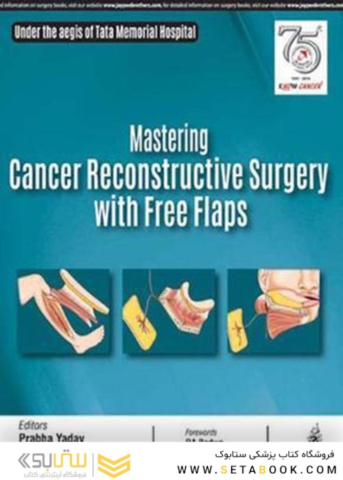 Mastering Cancer Reconstructive Surgery with Free Flaps2019