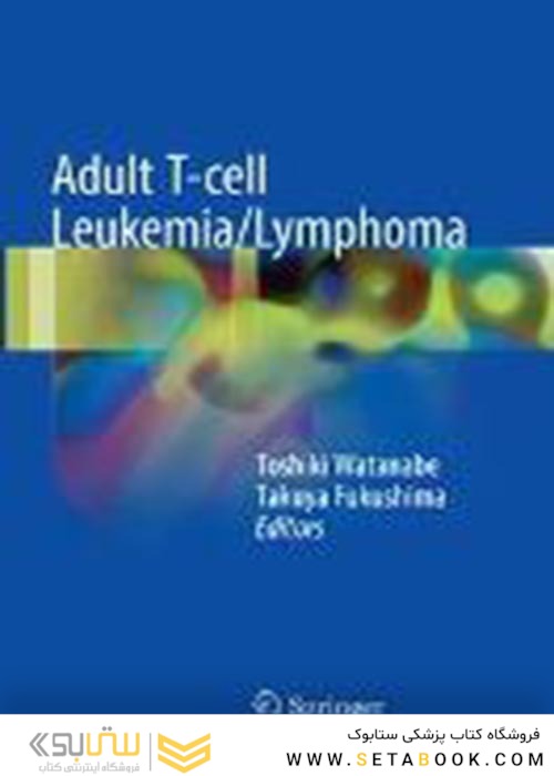 Adult T-cell Leukemia/Lymphoma2017