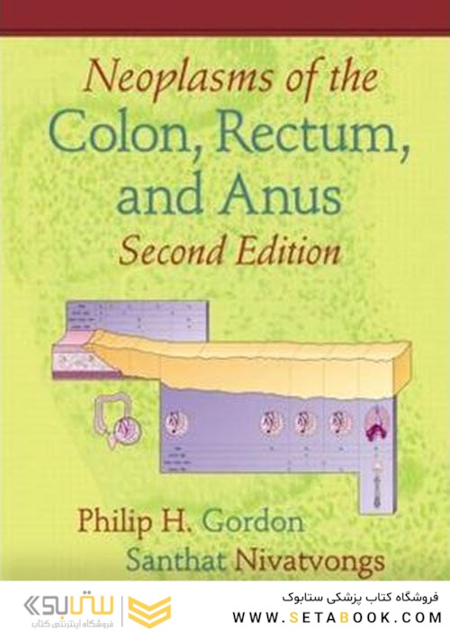 Neoplasms of the Colon, Rectum, and Anus2007