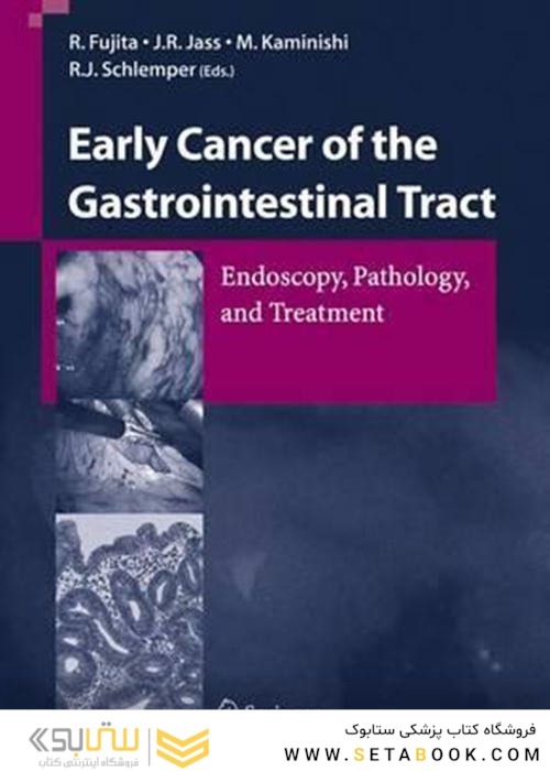 Early Cancer of the Gastrointestinal Tract : Endoscopy, Pathology, and Treatment2006