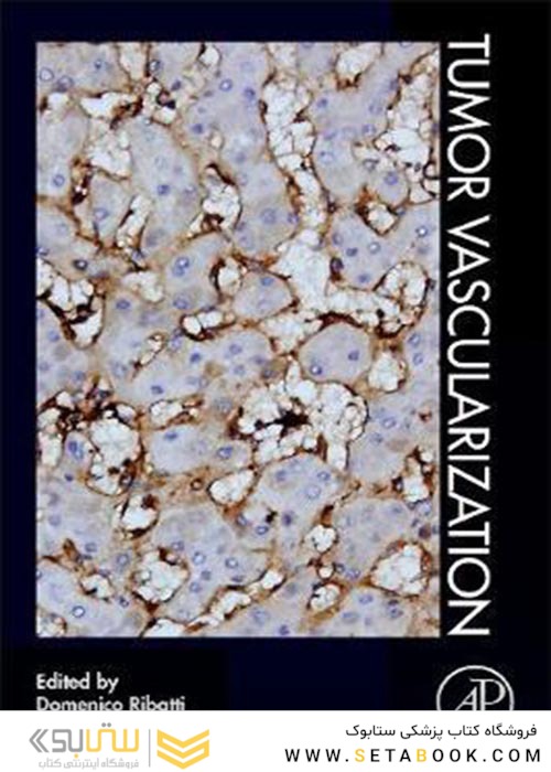 Tumor Vascularization
