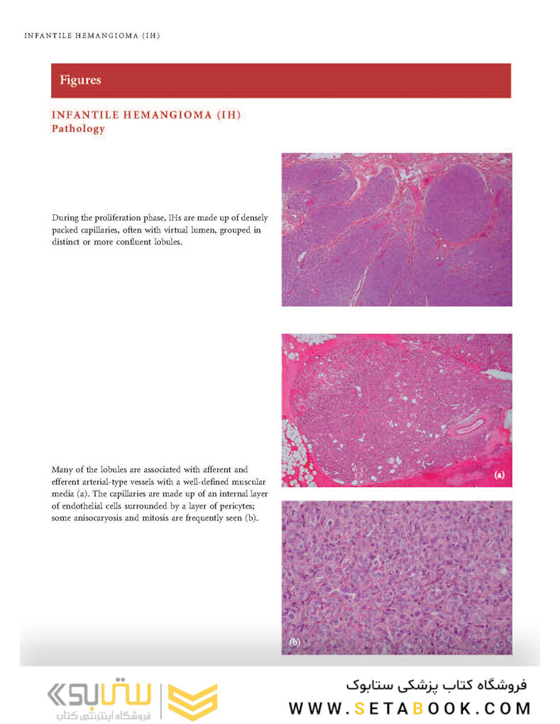 Color Atlas of Vascular Tumors and Vascular Malformations 1st Edicion 2007