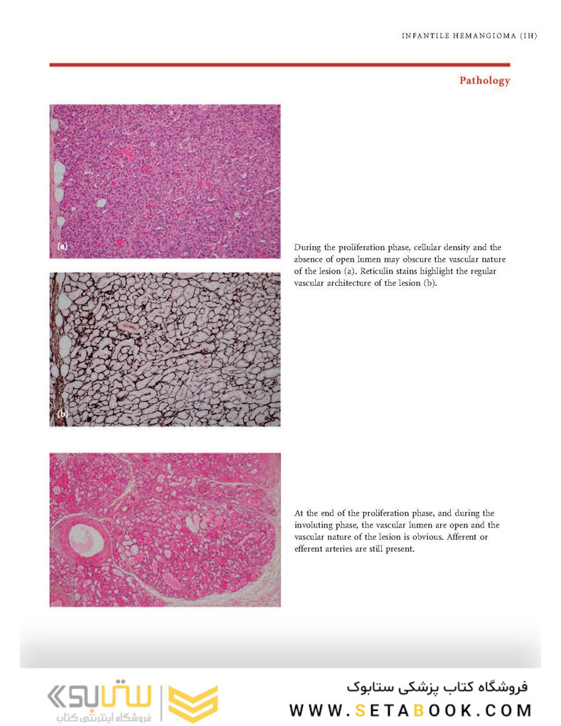Color Atlas of Vascular Tumors and Vascular Malformations 1st Edicion 2007