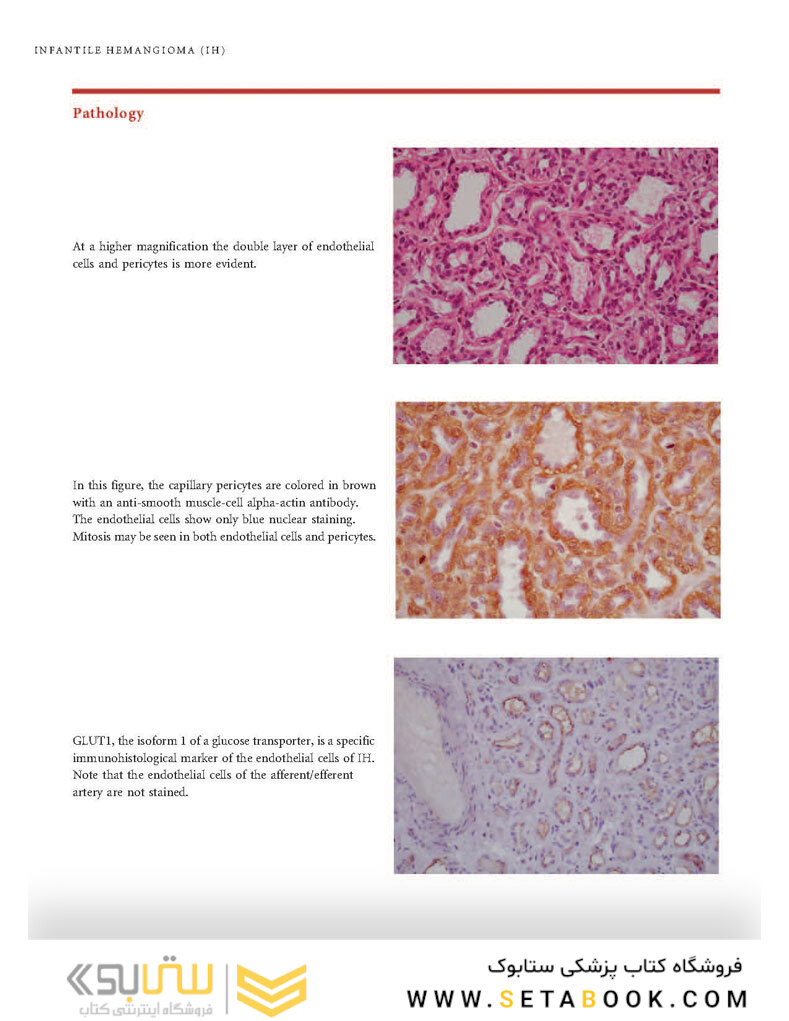 Color Atlas of Vascular Tumors and Vascular Malformations 1st Edicion 2007