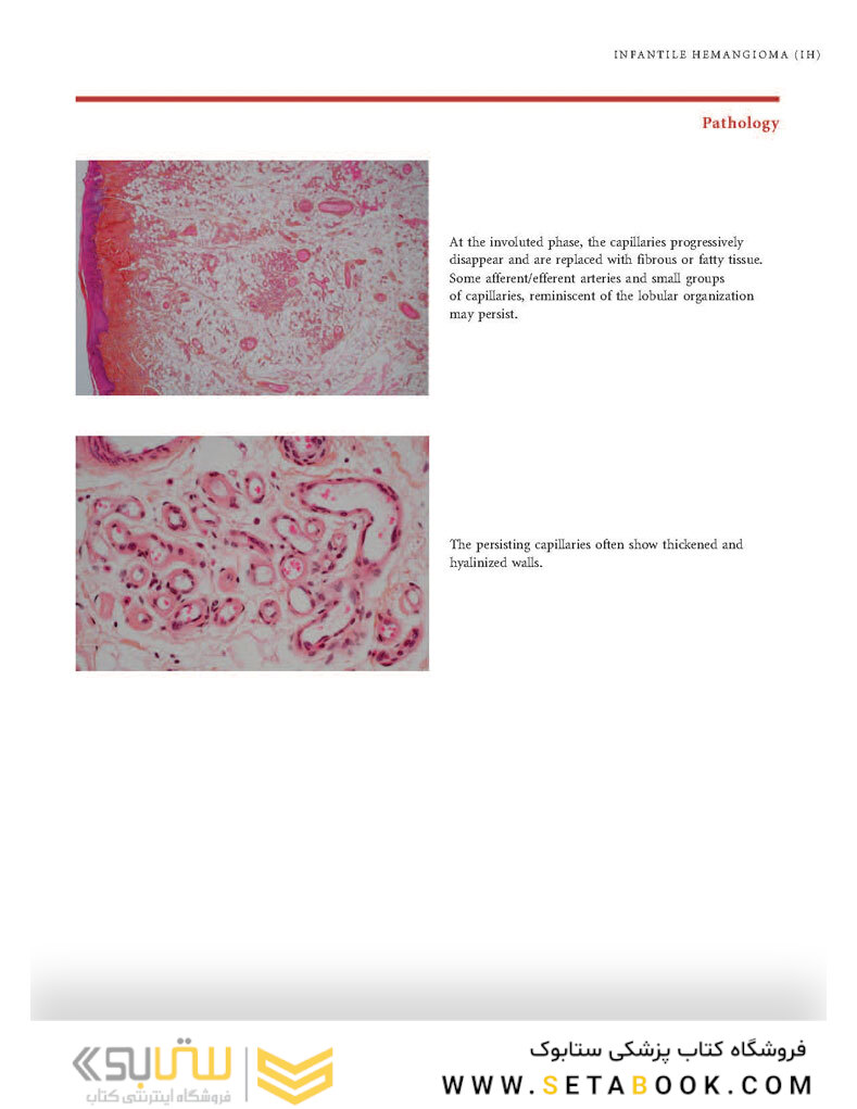 Color Atlas of Vascular Tumors and Vascular Malformations 1st Edicion 2007