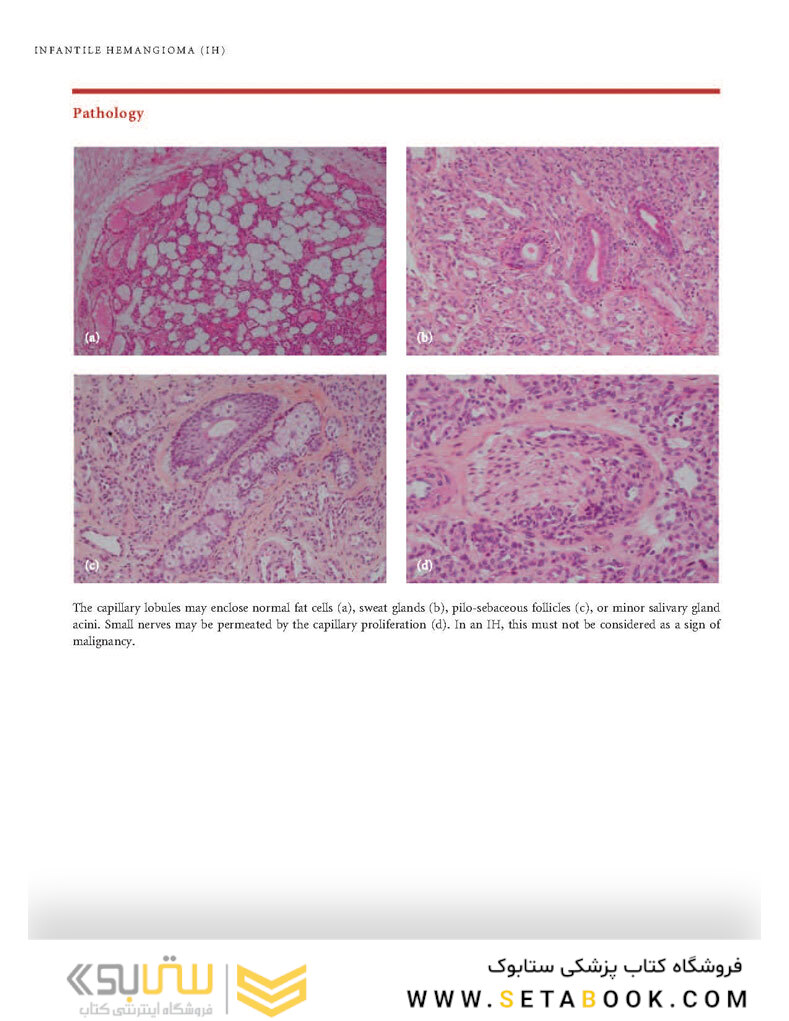 Color Atlas of Vascular Tumors and Vascular Malformations 1st Edicion 2007