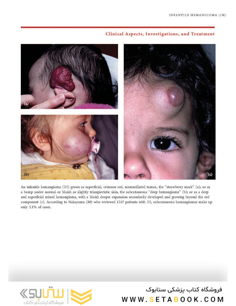 Color Atlas of Vascular Tumors and Vascular Malformations 1st Edicion 2007