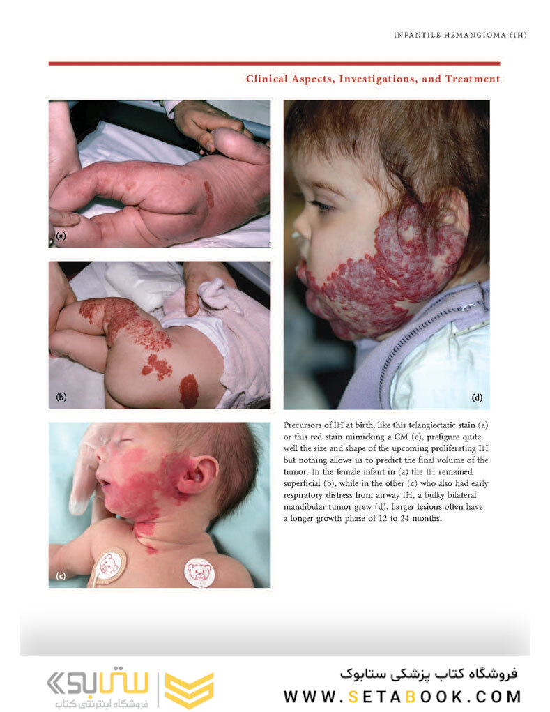 Color Atlas of Vascular Tumors and Vascular Malformations 1st Edicion 2007