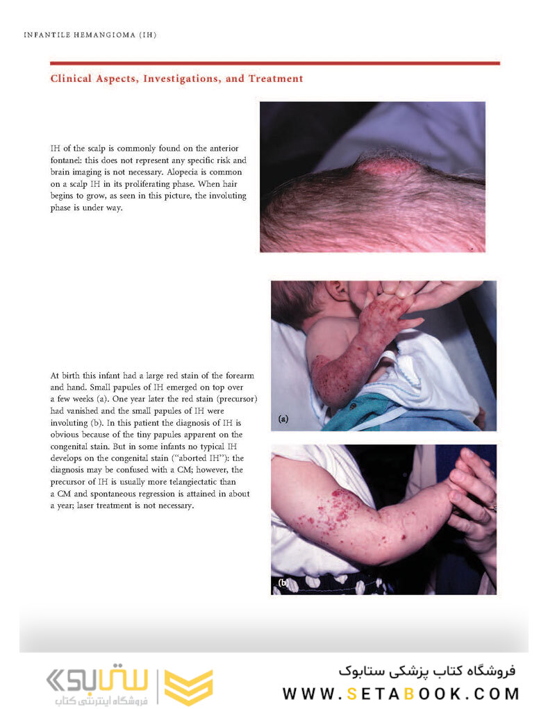 Color Atlas of Vascular Tumors and Vascular Malformations 1st Edicion 2007