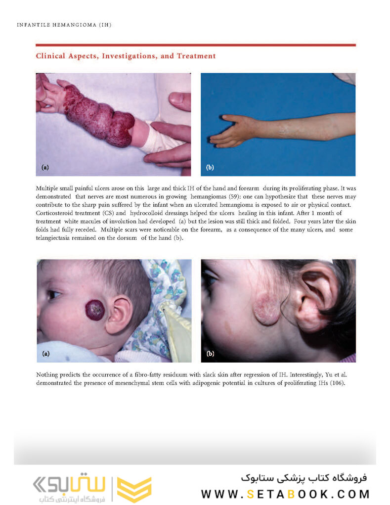 Color Atlas of Vascular Tumors and Vascular Malformations 1st Edicion 2007