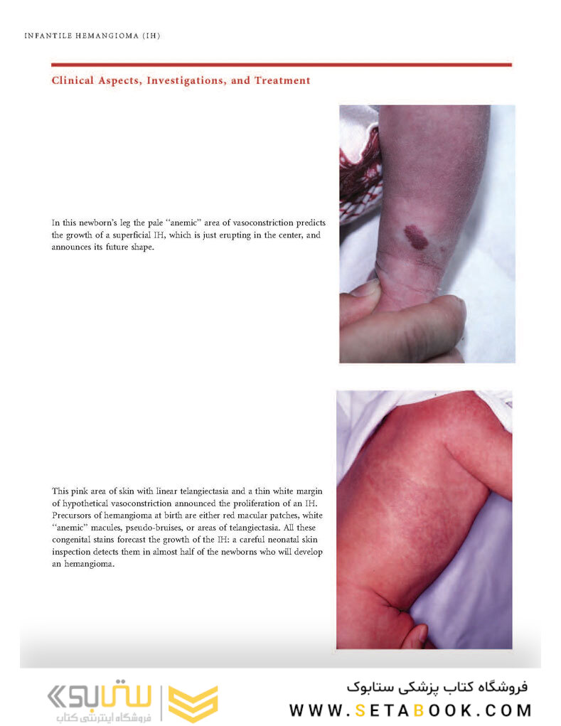 Color Atlas of Vascular Tumors and Vascular Malformations 1st Edicion 2007