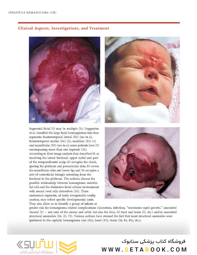 Color Atlas of Vascular Tumors and Vascular Malformations 1st Edicion 2007