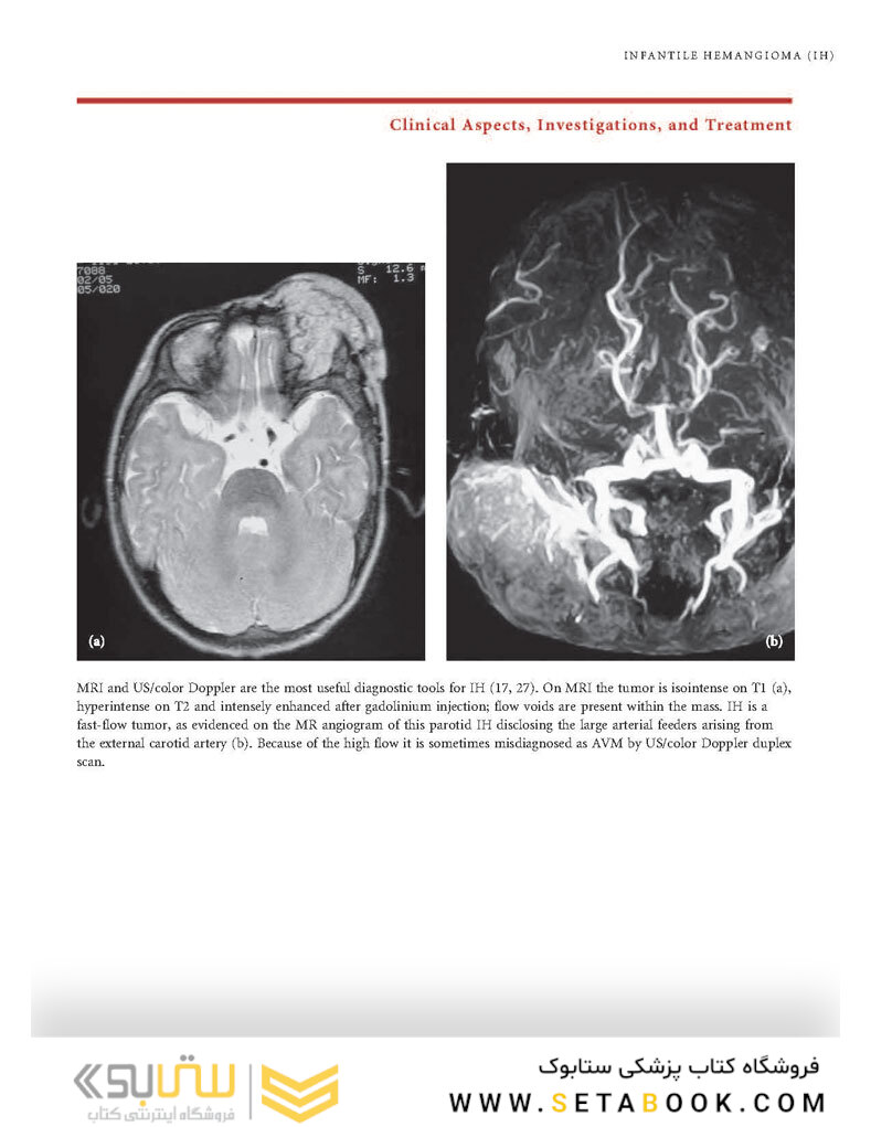 Color Atlas of Vascular Tumors and Vascular Malformations 1st Edicion 2007