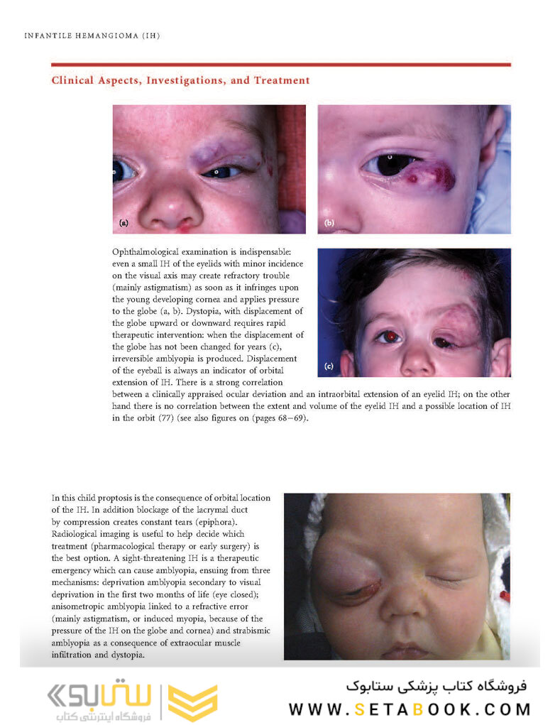 Color Atlas of Vascular Tumors and Vascular Malformations 1st Edicion 2007