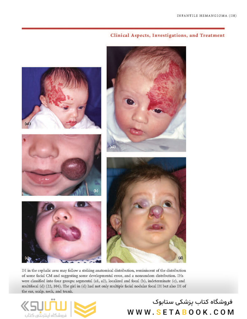 Color Atlas of Vascular Tumors and Vascular Malformations 1st Edicion 2007