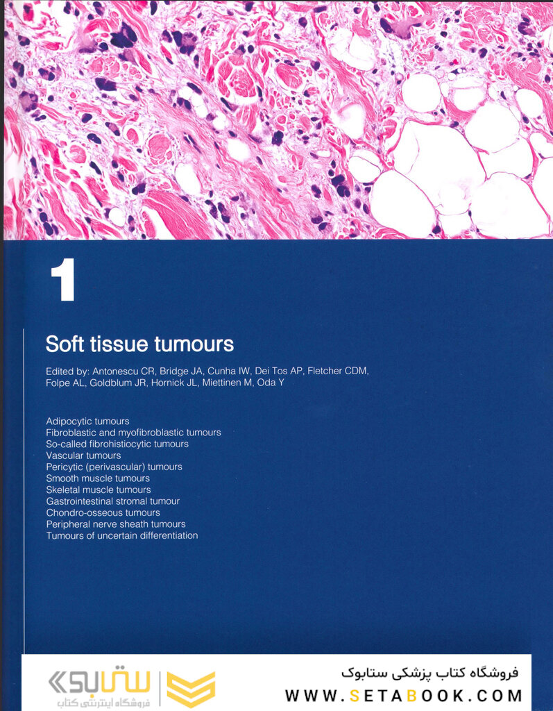 WHO classification of tumours of soft tissue and bone tumours 2020