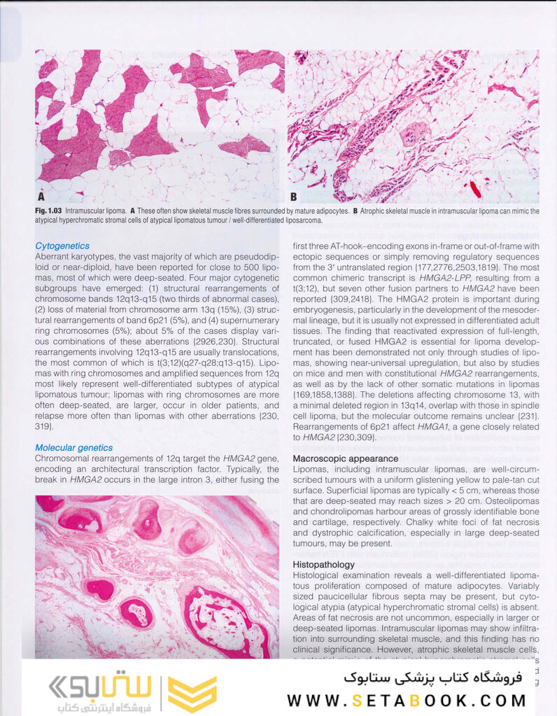 WHO classification of tumours of soft tissue and bone tumours 2020