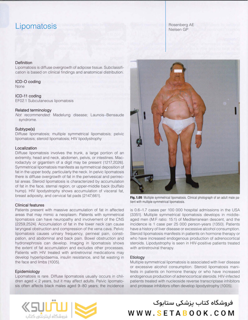 WHO classification of tumours of soft tissue and bone tumours 2020