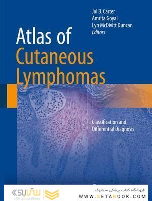 Atlas of Cutaneous Lymphomas : Classification and Differential Diagnosis2015اطلس لنفوم های جلدی: طبقه بندی و تشخیص افتراقی