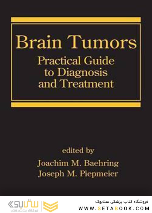 Brain Tumors : Practical Guide to Diagnosis and Treatment2006