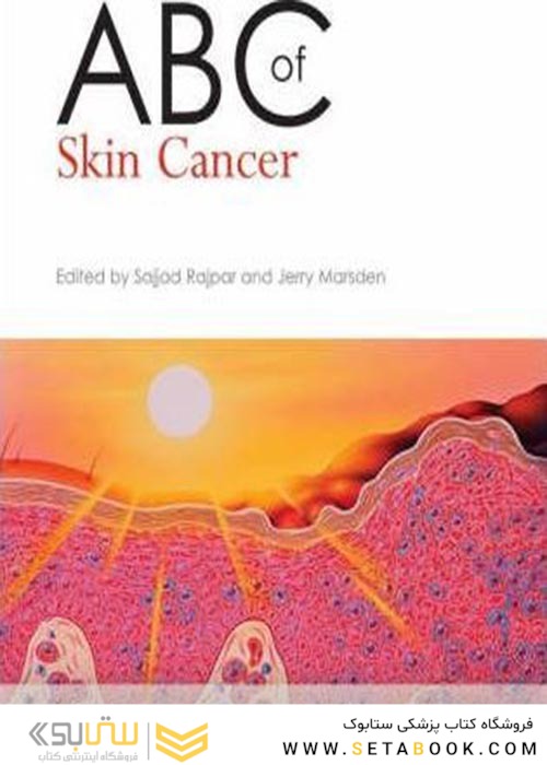ABC of Skin Cancer سرطان پوست