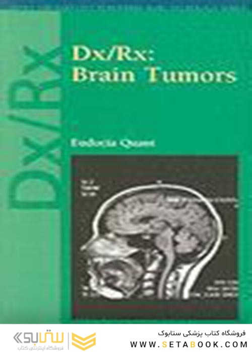 Dx/Rx : Brain Tumors