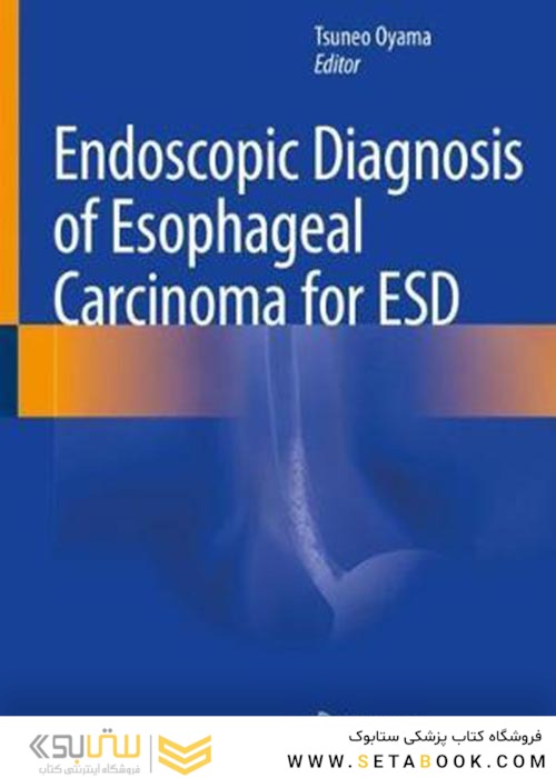 Endoscopic Diagnosis of Esophageal Carcinoma for ESD