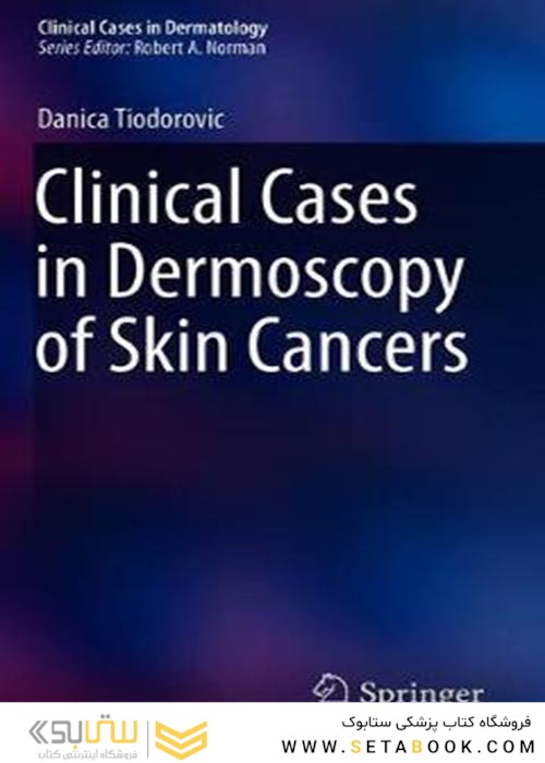 Clinical Cases in Dermoscopy of Skin Cancersموارد بالینی درموسکوپی سرطانهای پوست